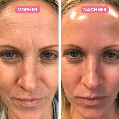 GlowFacial Pro Anti-Falten-Massagegerät