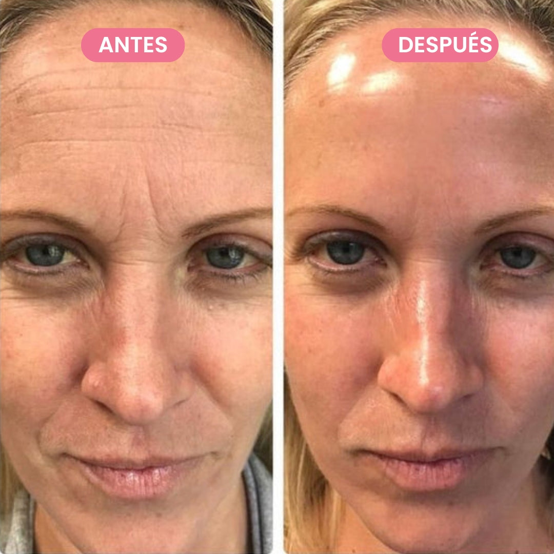 Masajeador Antiarrugas GlowFacial Pro