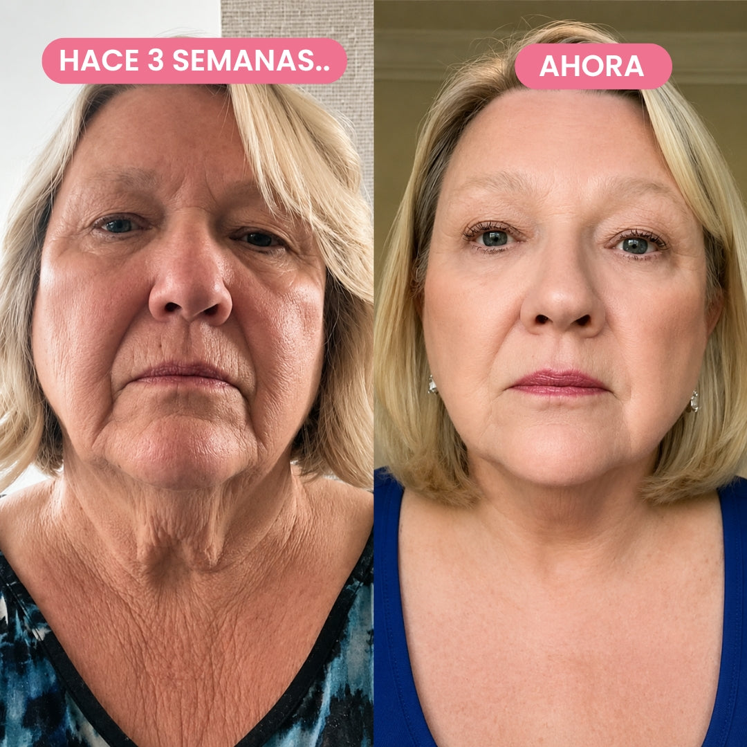 Masajeador Antiarrugas GlowFacial Pro